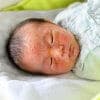 【医師監修】赤いプツプツ・・・乳児湿疹の原因・症状・ケア方法まとめ