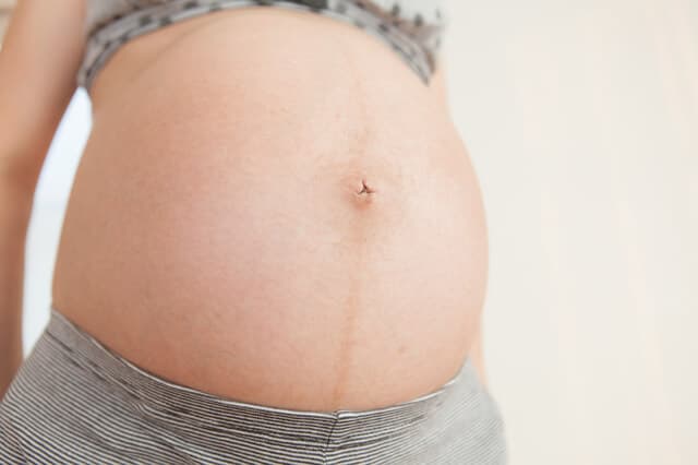 妊娠中にできた正中線は産後に消えるの？ その方法は？
