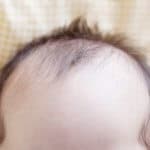 赤ちゃんが薄毛に見えるけど大丈夫？原因と対策法は？