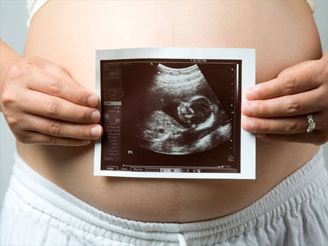 妊婦のおなかと赤ちゃんのエコー写真