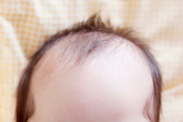 赤ちゃんの髪の毛が立つ理由
