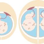 【医師監修】癒着胎盤の診断基準・症状・原因・治療・入院の必要性
